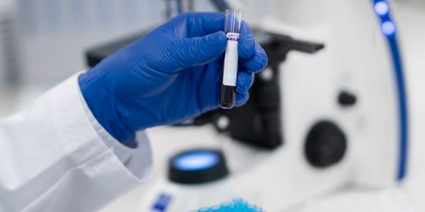 Prueba rápida de alcohol con envío a domicilio